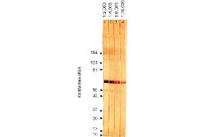 Western Blotting (WB) image for anti-Cytomegalovirus p65 (CMV p65) antibody (ABIN265537) (CMV p65 Antikörper)