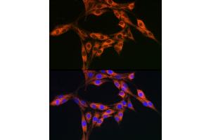 Immunofluorescence (IF) image for anti-Diazepam Binding Inhibitor (DBI) (AA 1-114) antibody (ABIN6139420)