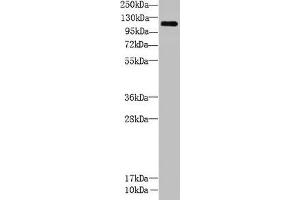 Western Blot All lanes: CCDC103 antibody at 5 μg/mL + Mouse heart tissue Secondary Goat polyclonal to rabbit IgG at 1/10000 dilution Predicted band size: 28, 12 kDa Observed band size: 111 kDa (CCDC13 Antikörper  (AA 1-242))