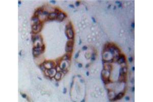 Used in DAB staining on fromalin fixed paraffin-embedded Kidney tissue (Merlin Antikörper  (AA 30-311))