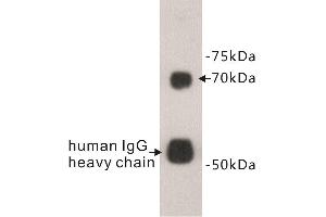 Western Blotting (WB) image for anti-Protein S (PROS) antibody (ABIN1855002) (PROS1 Antikörper)