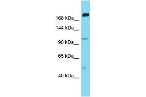 Host:  Rabbit  Target Name:  MAP4K5  Sample Type:  Thymus Tumor lysates  Antibody Dilution:  1.