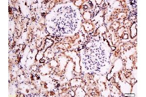 Formalin-fixed and paraffin embedded human kidney labeled with Anti- Pan FOXD Polyclonal Antibody, Unconjugated  at 1:200 followed by conjugation to the secondary antibody and DAB staining. (FOXD (AA 131-230) Antikörper)