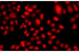 Immunofluorescence analysis of A549 cells using TEAD3 Polyclonal Antibody (TEAD3 Antikörper)
