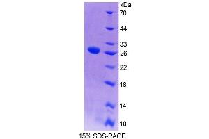 SDS-PAGE (SDS) image for Myelin Transcription Factor 1 (MYT1) (AA 905-1127) protein (His tag) (ABIN6239116)