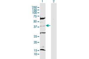 Western Blot analysis of CDK6 expression in transfected 293T cell line by CDK6 MaxPab polyclonal antibody. (CDK6 Antikörper  (AA 1-326))