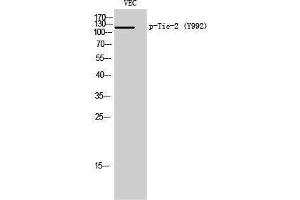 Western Blotting (WB) image for anti-TEK Tyrosine Kinase, Endothelial (TEK) (pTyr992) antibody (ABIN3173095) (TEK Antikörper  (pTyr992))