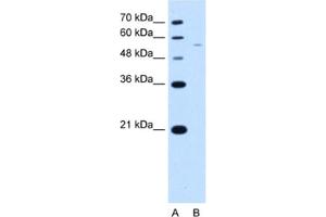 Western Blotting (WB) image for anti-arginine/serine-Rich Coiled-Coil 2 (RSRC2) antibody (ABIN2463413) (RSRC2 Antikörper)