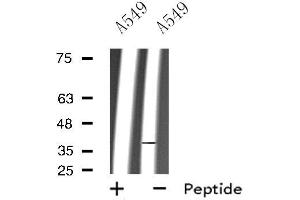 Western blot analysis of extracts from A549 cells, using RHO antibody. (Rho-related GTP-binding protein Antikörper)