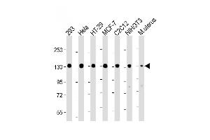 All lanes : Anti-Phospho-MYPT1 (Ser507) Antibody: Ctrl at 1:4000 dilution Lane 1: 293 whole cell lysate Lane 2: Hela whole cell lysate Lane 3: HT-29 whole cell lysate Lane 4: MCF-7 whole cell lysate Lane 5: C2C12 whole cell lysate Lane 6: NIH/3T3 whole cell lysate Lane 7: Mouse uterus lysate Lysates/proteins at 20 μg per lane.