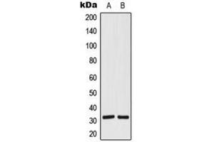 Western blot analysis of SIAH1/2 expression in HeLa (A), Jurkat (B) whole cell lysates. (SIAH1/2 Antikörper  (Center))