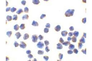 Immunocytochemistry of CTRP7 in 293 cells with AP30260PU-N CTRP7 antibody at 10 μg/ml. (CTRP7 Antikörper)