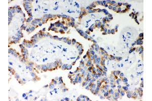Immunohistochemistry (IHC) image for anti-Inositol 1,4,5-Trisphosphate Receptor, Type 3 (ITPR3) (AA 70-95), (N-Term) antibody (ABIN3043863)
