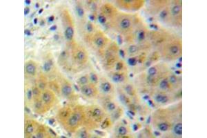IHC-P analysis of Liver tissue, with DAB staining. (ADH1 Antikörper  (AA 25-228))