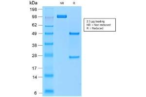 SDS-PAGE analysis of purified, BSA-free recombinant TRAcP antibody (clone rACP5/1070) as confirmation of integrity and purity. (ACP5 Antikörper)