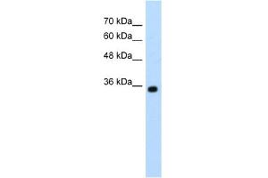 WB Suggested Anti-ZMYND11 Antibody Titration:  1. (ZMYND11 Antikörper  (N-Term))