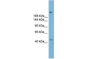 WB Suggested Anti-RBBP6 Antibody Titration:  0.