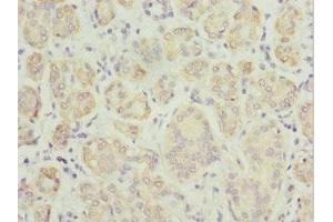 Immunohistochemistry of paraffin-embedded human salivary gland tissue using ABIN7173912 at dilution of 1:100 (TPD52L1 Antikörper  (AA 1-144))