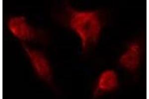 ABIN6275989 staining HUVEC by IF/ICC. (FSHR Antikörper  (Internal Region))