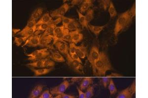 Immunofluorescence analysis of C6 cells using RPL17 Polyclonal Antibody at dilution of 1:100. (RPL17 Antikörper)