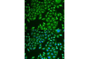 Immunofluorescence analysis of U2OS cells using PNLIP antibody. (PNLIP Antikörper)