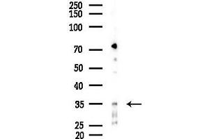 anti-Nanog Homeobox Pseudogene 8 (NANOGP8) (Internal Region) antibody