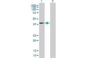 Western Blot analysis of UPP2 expression in transfected 293T cell line by UPP2 MaxPab polyclonal antibody. (UPP2 Antikörper  (AA 1-317))