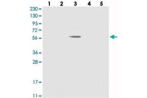 Western blot analysis of Lane 1: RT-4, Lane 2: U-251 MG, Lane 3: Human Plasma, Lane 4: Liver, Lane 5: Tonsil with SLC43A3 polyclonal antibody .