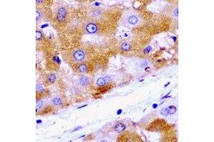 Immunohistochemical analysis of HADH staining in rat liver  formalin fixed paraffin embedded tissue section. (HADH Antikörper)