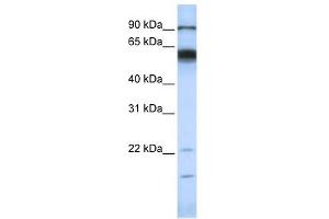 MMP16 antibody used at 1 ug/ml to detect target protein. (MMP16 Antikörper)