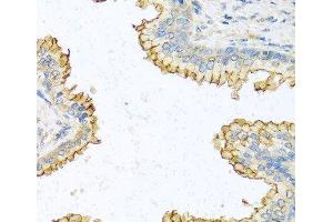 Immunohistochemistry of paraffin-embedded Human prostate using RNASE13 Polyclonal Antibody at dilution of 1:100 (40x lens). (RNASE13 Antikörper)