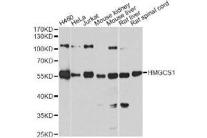 Western blot analysis of extracts of various cell lines, using HMGCS1 antibody. (HMGCS1 Antikörper  (AA 241-520))