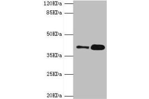 Western blot All lanes: GDAP1 antibody at 4. (GDAP1 Antikörper  (AA 1-225))