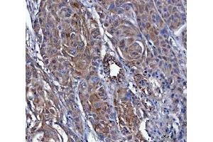IHC analysis of Dicer/DICER1 using anti-Dicer/DICER1 antibody (ABIN3043347).