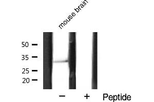 estern blot analysis of Cyclin D1 expression in mouse brain tissue lysates,The lane on the right is treated with the antigen-specific peptide.