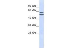 Image no. 1 for anti-Phosphatidylinositol Glycan Anchor Biosynthesis, Class Q (PIGQ) (AA 144-193) antibody (ABIN6740970) (PIGQ Antikörper  (AA 144-193))