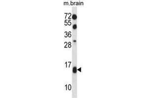 Western Blotting (WB) image for anti-Transcription Elongation Factor B (SIII), Polypeptide 2 (18kDa, Elongin B) (TCEB2) (AA 1-29), (N-Term) antibody (ABIN955125)