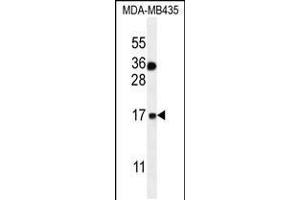 Western blot analysis in MDA-MB435 cell line lysates (35ug/lane). (S100A1 Antikörper  (C-Term))