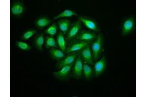 Immunofluorescence staining of A549 cells with ABIN7157591 at 1:133, counter-stained with DAPI. (KIF13B Antikörper  (AA 1531-1701))