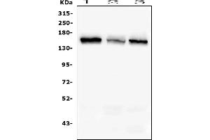 Western blot analysis of RAB3GAP2 using anti-RAB3GAP2 antibody (ABIN6719633). (RAB3GAP2 Antikörper  (AA 1-115))
