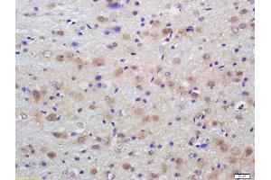 Formalin-fixed and paraffin embedded rat brain labeled with Anti-Phospho-Dab1 (Tyr198)Polyclonal Antibody, Unconjugated  at 1:200 followed by conjugation to the secondary antibody and DAB staining (DAB1 Antikörper  (pTyr198))