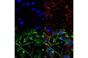 Immunocytochemistry/Immunofluorescence analysis using Mouse Anti-VAChT Monoclonal Antibody, Clone S6-38 (ABIN2485328). (SLC18A3 Antikörper  (AA 521-532) (FITC))