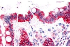 Immunohistochemical (Formalin/PFA-fixed paraffin-embedded sections) staining in human colon, epithelium with PTGDR polyclonal antibody . (PTGDR Antikörper  (3rd Extracellular Domain))