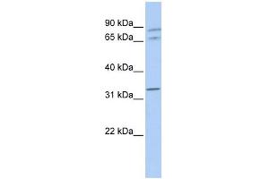 GJA4 antibody used at 1 ug/ml to detect target protein. (GJA4 Antikörper  (Middle Region))