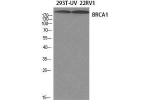 Western Blot analysis of 293T-UV, 22RV1 cells using BRCA1 Polyclonal Antibody at dilution of 1:1000. (BRCA1 Antikörper)