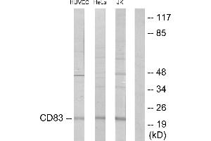 Immunohistochemistry analysis of paraffin-embedded human lung carcinoma tissue using CD83 antibody. (CD83 Antikörper)