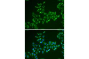 Immunofluorescence analysis of HeLa cells using CRAT antibody (ABIN5973772). (CRAT Antikörper)