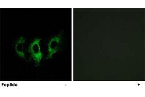 Immunofluorescence analysis of A-549 cells, using GFM2 polyclonal antibody .