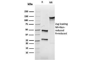 SDS-PAGE Analysis Purified Aurora B Recombinant Mouse Monoclonal Antibody (rAURKB/1592). (Rekombinanter Aurora Kinase B Antikörper  (AA 89-251))