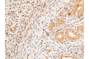 ABIN6267218 at 1/100 staining rat uterine tissue sections by IHC-P. (SGK1 Antikörper  (pSer422))